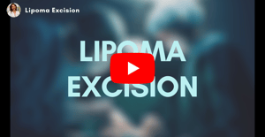 Lipoma Excision | Supriya Dermatology