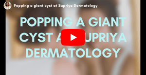 Popping a giant pimple at Supriya Dermatology
