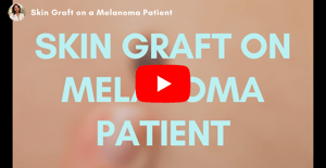 Melanoma Skin Graft | Supriya Dermatology