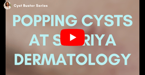 Popping cysts at Supriya Dermatology