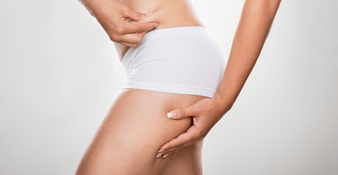 5 cellulite myths busted