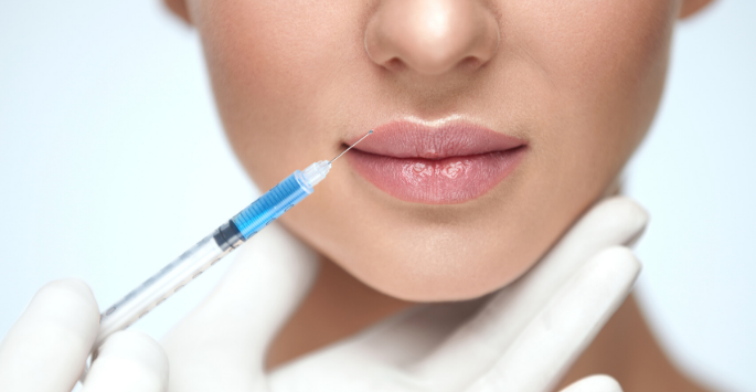 8 Things to know about lip fillers blog