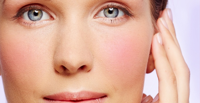 Laser Rosacea Therapy