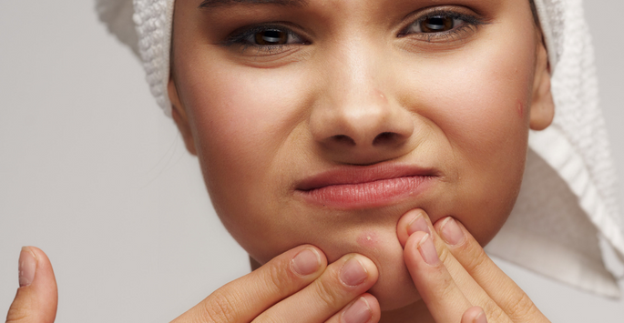 How to Cover Acne | Supriya Tomar MD | West Palm Beach Dermatologist